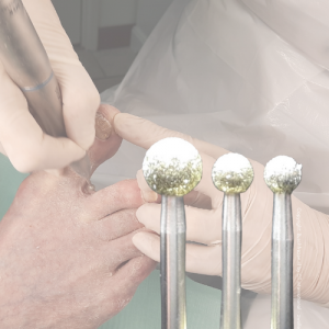 delige grote bolkopset met copyright