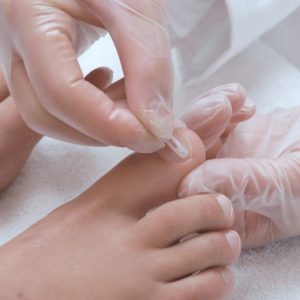 PodofixSpangest.verschillendematen