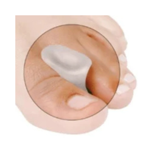 Gelsmart M-Gel Siliconen Teenspreider