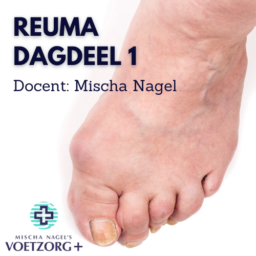 reuma dagdeel 1