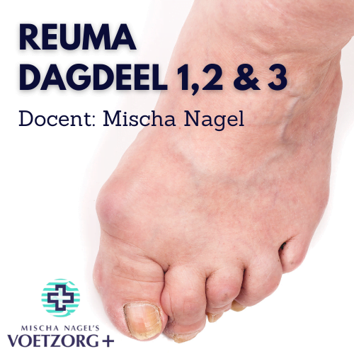 reuma mischa nagel